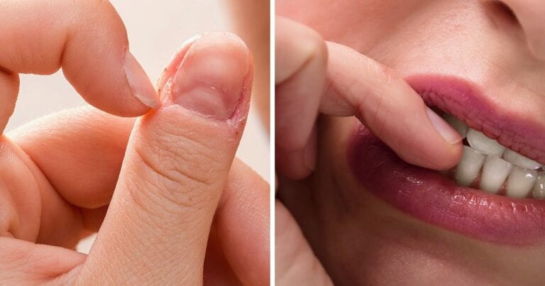5 lucruri pe care obiceiul tău de a-ti roade unghiile le poate dezvălui